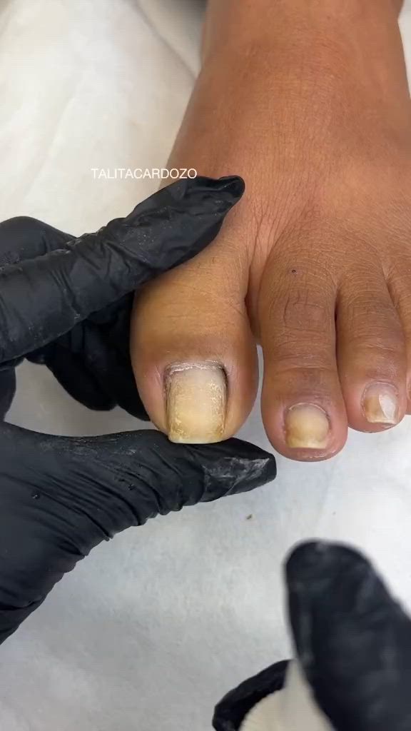 Pedicure Simples